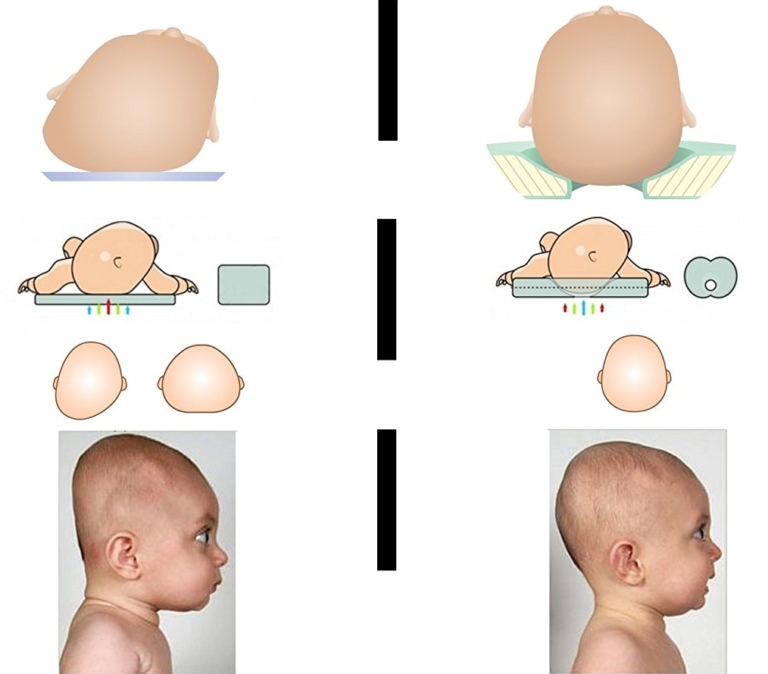 【ᐅᐅ】 Lagerungskissen Baby Infos, Empfehlungen & Kaufberatung ᐅ NEU